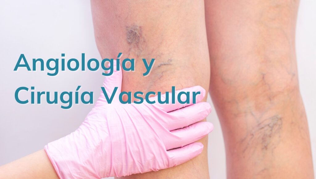 Angiología y cirugía vascular