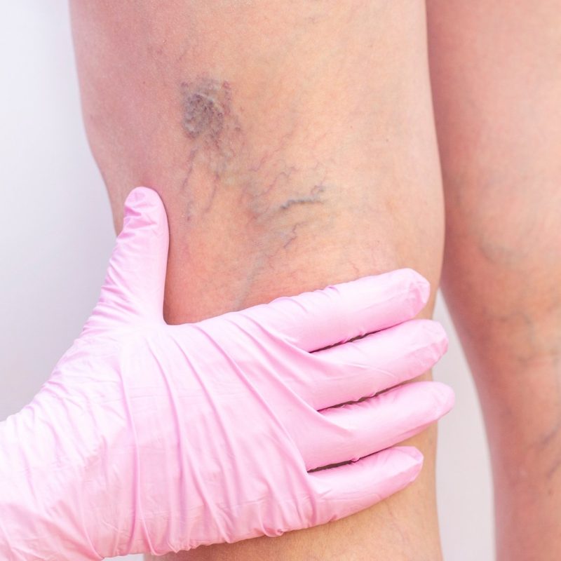 Cirugía vascular y angiología