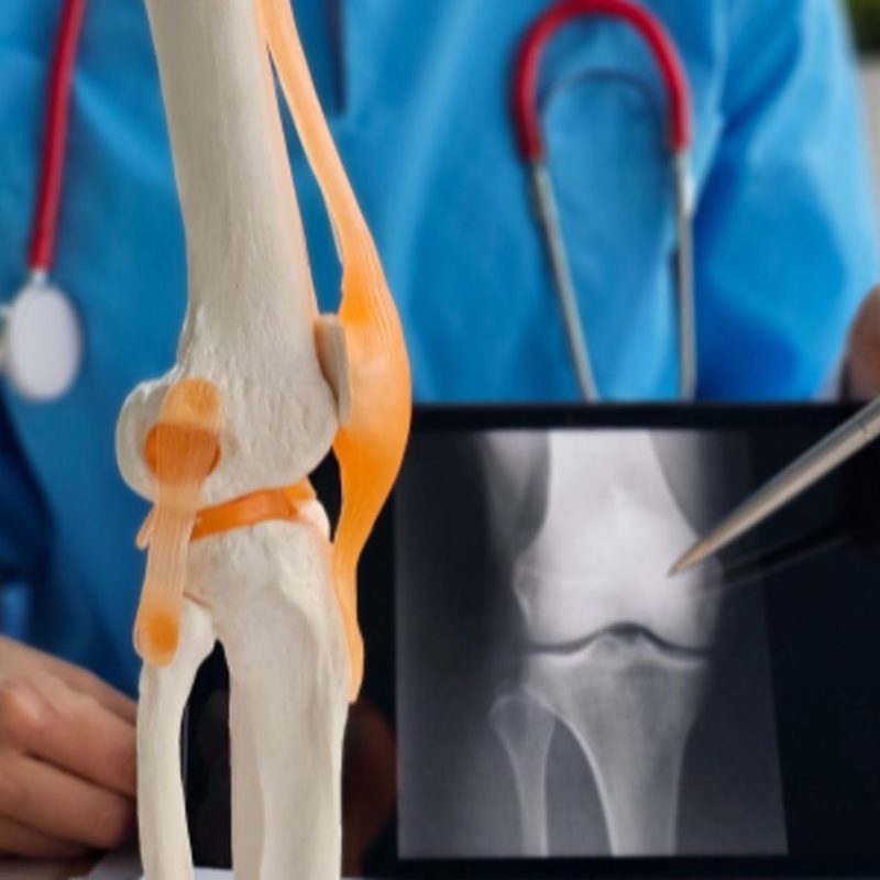 Traumatólogo rodilla Valencia